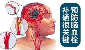 預(yù)防腦血栓 補硒很關(guān)鍵