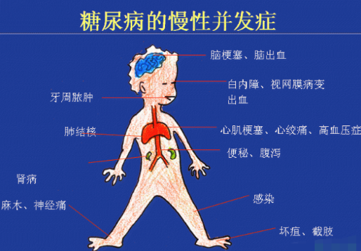 你還在害怕糖尿病嗎?科學補硒不“恐糖”