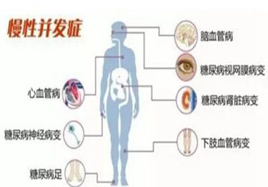 遠(yuǎn)離高血糖并發(fā)癥，請記住一點(diǎn)，學(xué)會“補(bǔ)硒”