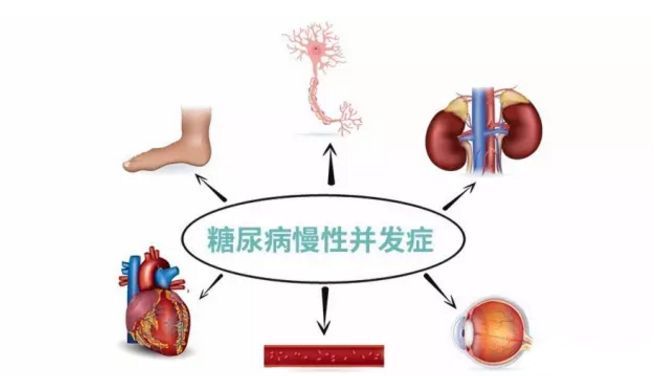 血糖波動大，并發(fā)癥來得快，糖友要多補(bǔ)硒
